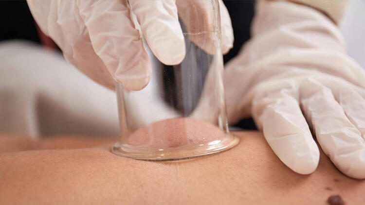 Hacamat yaptırırken hastalık bulaşabilir!